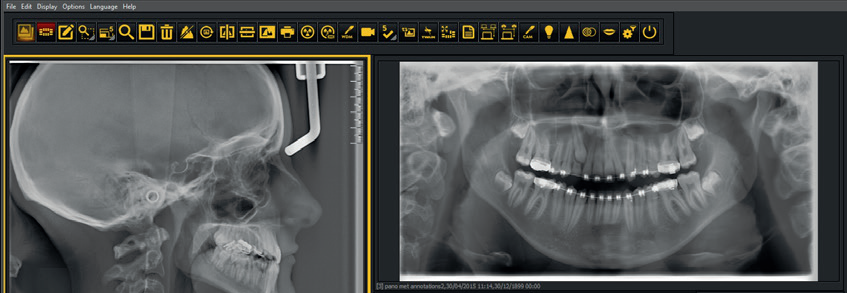 Bildprogram för dentala bilder